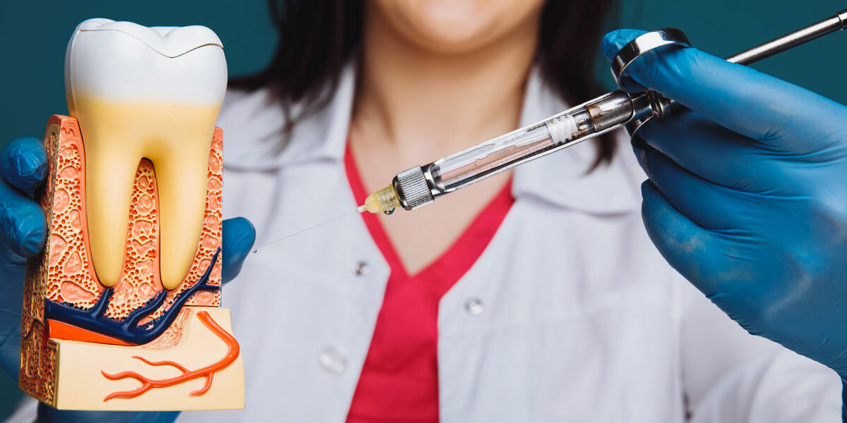 tartre-dentaire-modogo